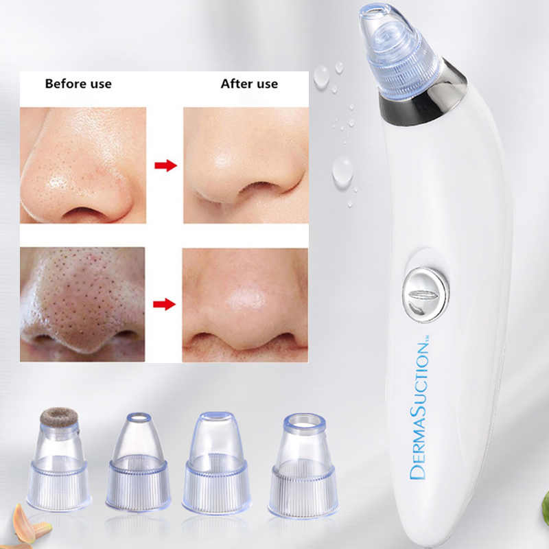 Derma Suction Blackhead Remover – Electric Pore Cleaner for Nose and Face, Deep Cleansing Skin Care machine